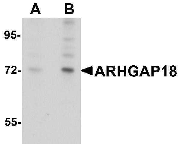 Western blot analysis of ARHGAP18 in 3T3 cell lysate with ARHGAP18 antibody at (A) 1 and (B) 2 μg/mL