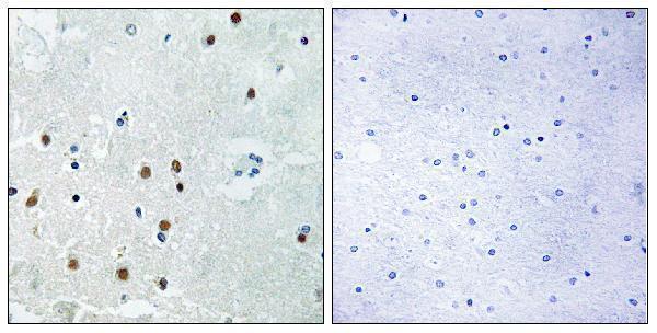 a08418 arhgap18 primary antibodies ihc testing 1