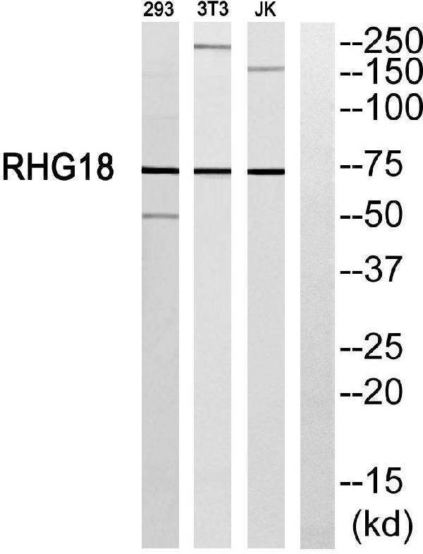 a08418 arhgap18 primary antibodies wb testing 4