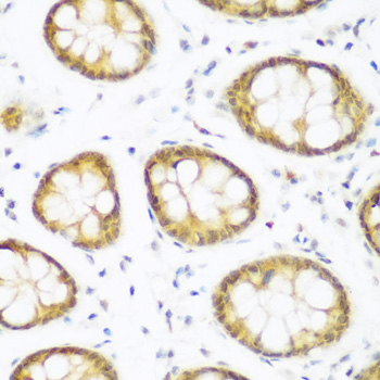 a08420 brd9 primary antiboties ihc testing 1