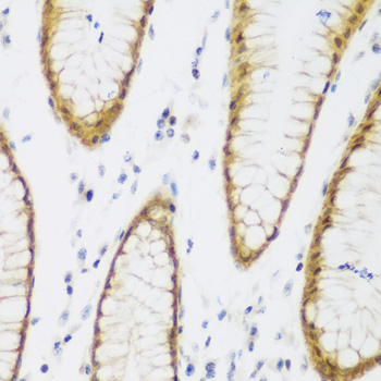 a08420 brd9 primary antiboties ihc testing 3