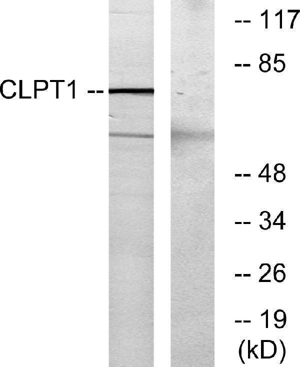 a08423 clptm1 primary antibodies wb testing 1