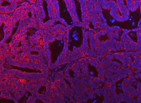 a08425 1 sars2 primary antibodies if testing 10