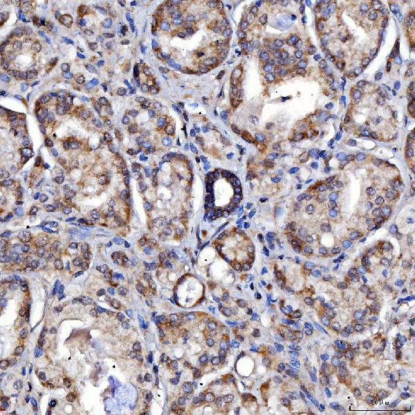  IHC analysis of SARS2 using anti-SARS2 antibody (A08425-1)