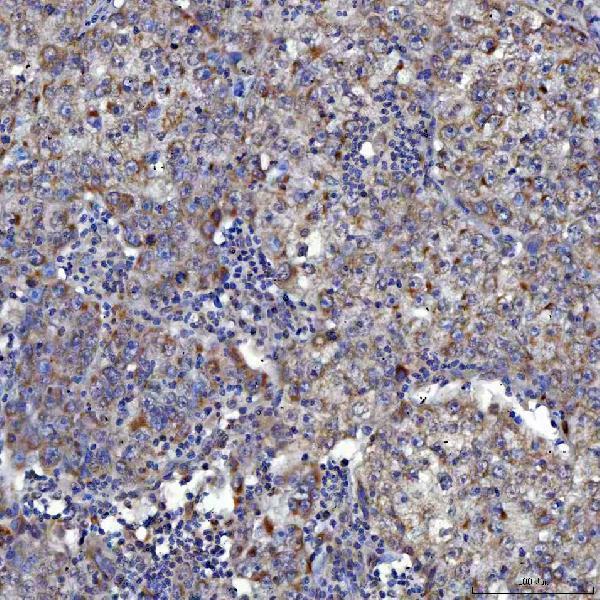  IHC analysis of SARS2 using anti-SARS2 antibody (A08425-1)