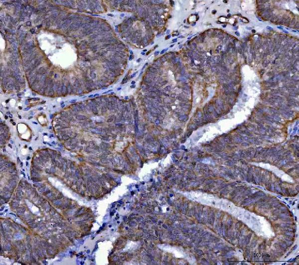 a08425 1 sars2 primary antibodies ihc testing 5