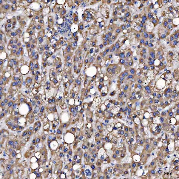 a08425 1 sars2 primary antibodies ihc testing 6