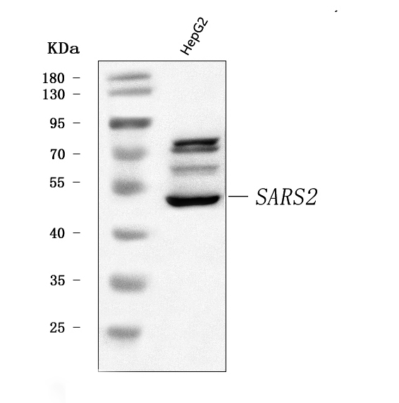  Western blot analysis of SARS2 using anti-SARS2 antibody (A08425-1)