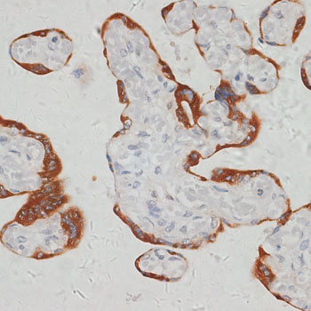 a08425 sars2 primary antiboties ihc testing 2