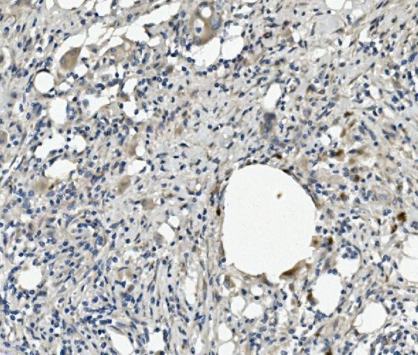 a08426 serpina4 primary antibodies ihc testing 2