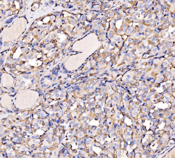 a08428 2 hectd1 primary antibodies ihc testing 2