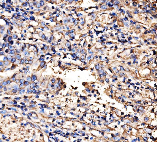a08428 2 hectd1 primary antibodies ihc testing 3
