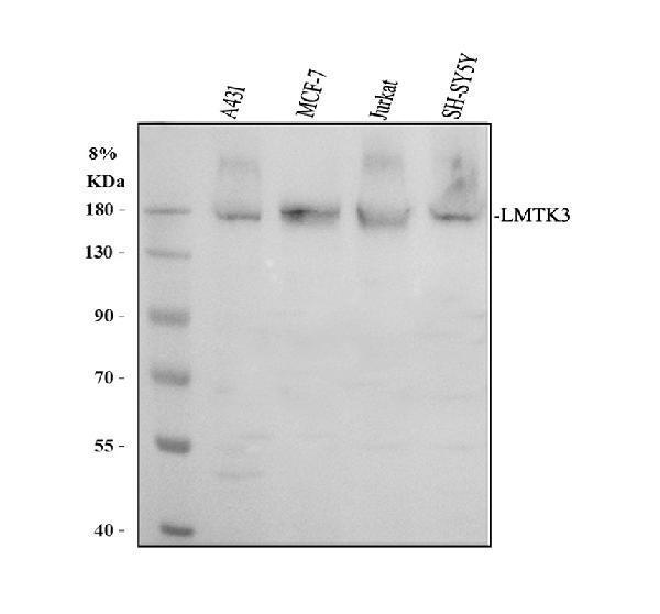 a08432 2 lmtk3 primary antibodies wb testing 1