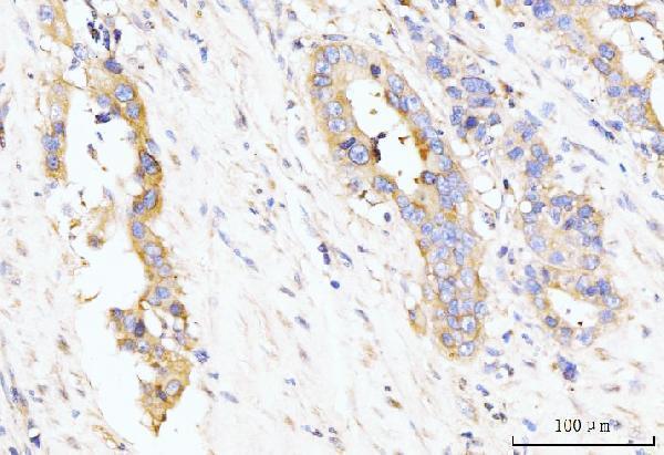 a08433 1 larp4b primary antibodies ihc testing 2