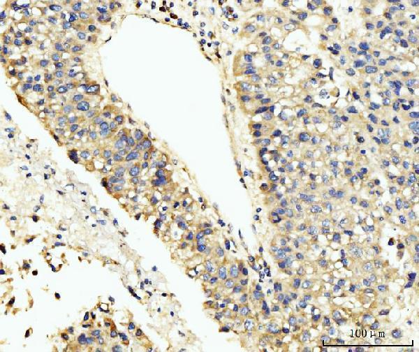 a08433 1 larp4b primary antibodies ihc testing 3