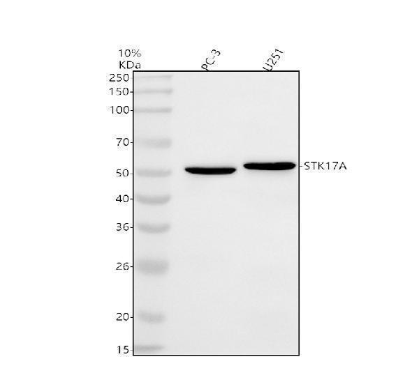  Western blot analysis of STK17A using anti-STK17A antibody (A08436-1)