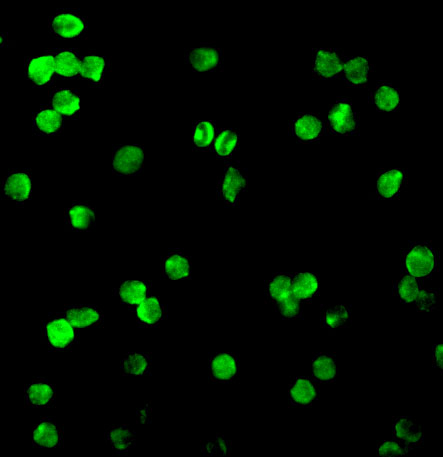 Immunofluorescence of DRAK1 in Molt cells with DRAK1 antibody at 20 μg/mL