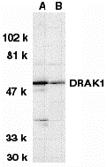 Western blot analysis of DRAK1 in (A) MOLT4 and (B) A431 whole cell lysates with DRAK1 antibody at 1 μg/mL