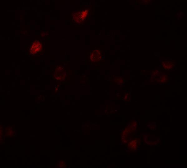 Immunofluorescence of CCDC22 in human brain tissue with CCDC22 antibody at 20 μg/mL