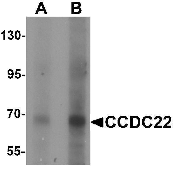 Western blot analysis of CCDC22 in 293 cell lysate with CCDC22 antibody at (A) 1 and (B) 2 μg/mL