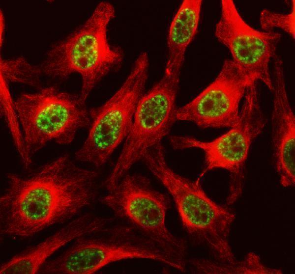 a08440 1 ddx46 primary antibodies if testing 1