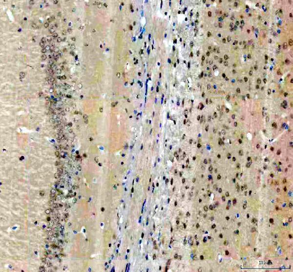 IHC analysis of DDX46 using anti-DDX46 antibody (A08440-1)