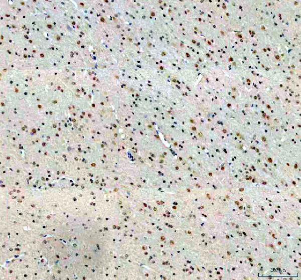 IHC analysis of DDX46 using anti-DDX46 antibody (A08440-1)