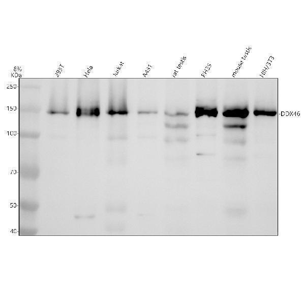 Western blot analysis of DDX46 using anti-DDX46 antibody (A08440-1)