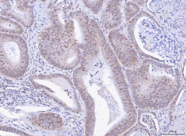  IHC analysis of TOX using anti-TOX antibody (A08441-2)