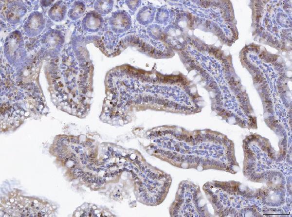  IHC analysis of TOX using anti-TOX antibody (A08441-2)
