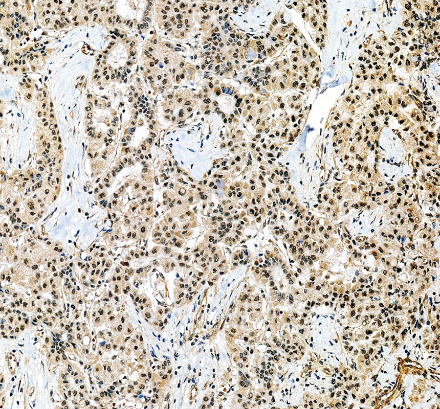a08443 1 thoc2 primary antibodies ihc testing 1