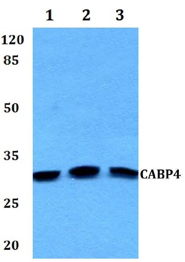 a08449 cabp4 primary antiboties wb testing 1