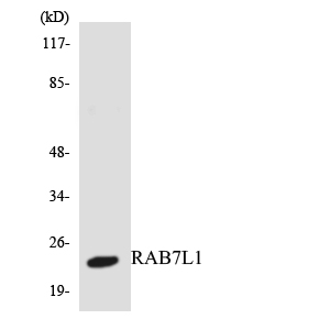 Western blot analysis of the lysates from HepG2 cells using RAB7L1 antibody