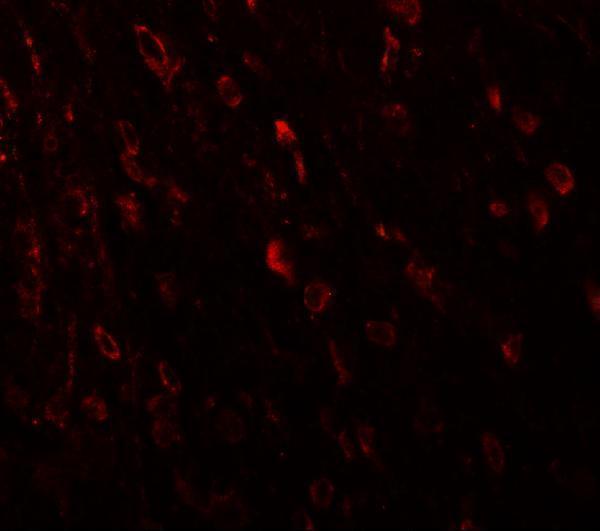 Immunofluorescence of TSHZ3 in mouse brain tissue with TSHZ3 antibody at 20 μg/mL