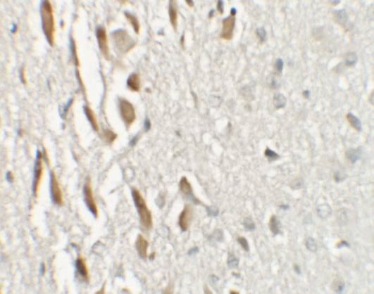 Immunohistochemistry of TSHZ3 in mouse brain tissue with TSHZ3 antibody at 2