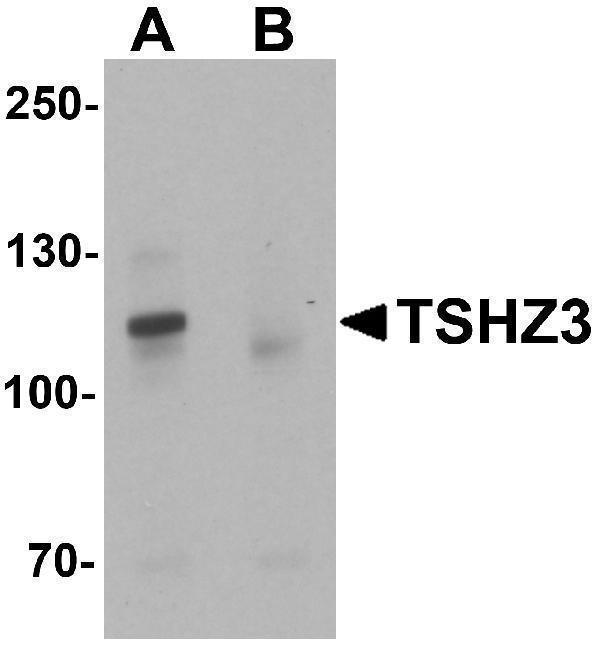 Western blot analysis of TSHZ3 in mouse brain tissue lysate with TSHZ3 antibody at 1 μg/mL in (A) the absence and (B) the presence of blocking peptide