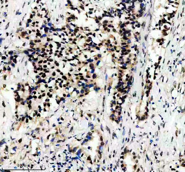 IHC analysis of EMG1 using anti-EMG1 antibody (A08458-1)