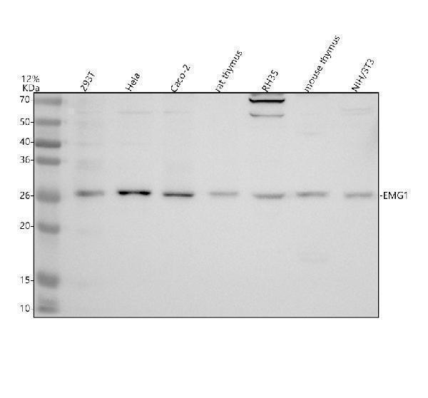 Western blot analysis of EMG1 using anti-EMG1 antibody (A08458-1)