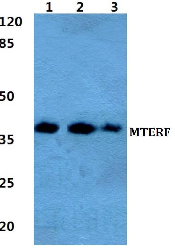 Western blot (WB) analysis of MTERF polyclonal antibody at 1:500 dilution
Lane1:Hela cell lysate
Lane2:Raw264