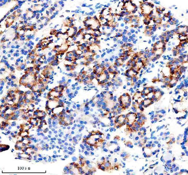  IHC analysis of MINPP1 using anti-MINPP1 antibody (A08462-3)