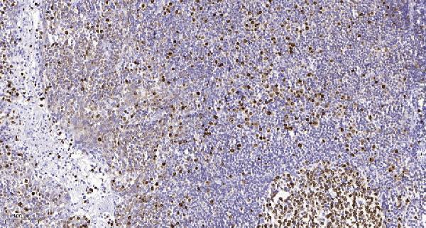 a08466 gtf2h2 primary antibodies ihc testing 1