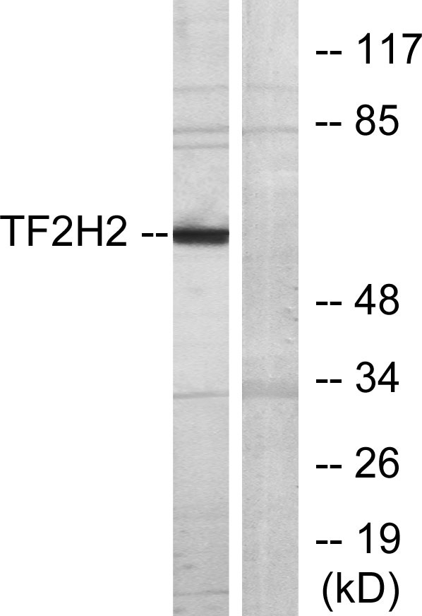 Western blot analysis of lysates from COLO205 cells, using TF2H2 Antibody