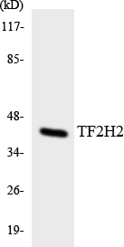 Western blot analysis of the lysates from COLO205 cells using TF2H2 antibody