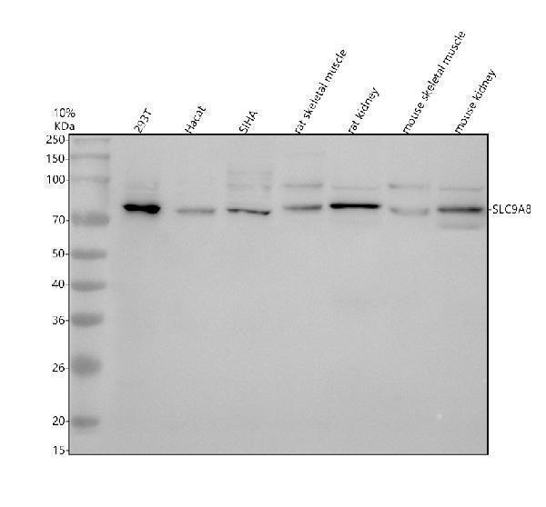 Western blot analysis of SLC9A8 using anti-SLC9A8 antibody (A08467-2)