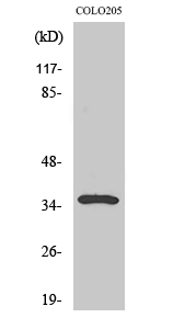 Western blotting validation for Anti-Galectin-4 LGALS4 Antibody A08468
Western Blot (WB) analysis of specific cells using Galectin-4 polyclonal antibody