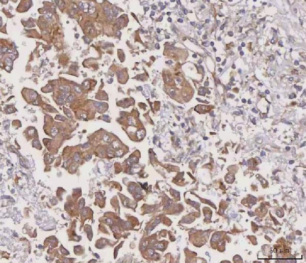  IHC analysis of MGAT3 using anti-MGAT3 antibody (A08470-1)