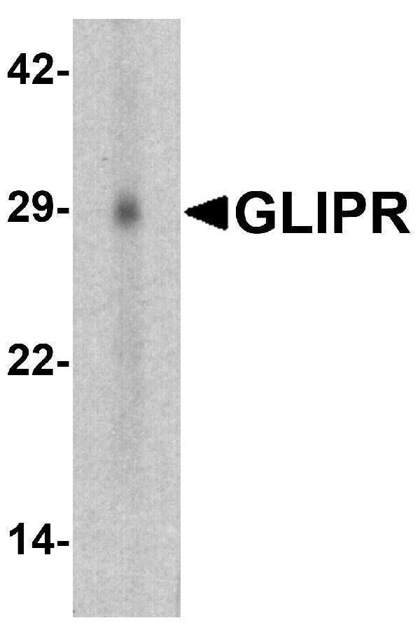 Western blot analysis of GLIPR1 in human small intestine tissue lysate with GLIPR1 antibody at 1 μg/ml