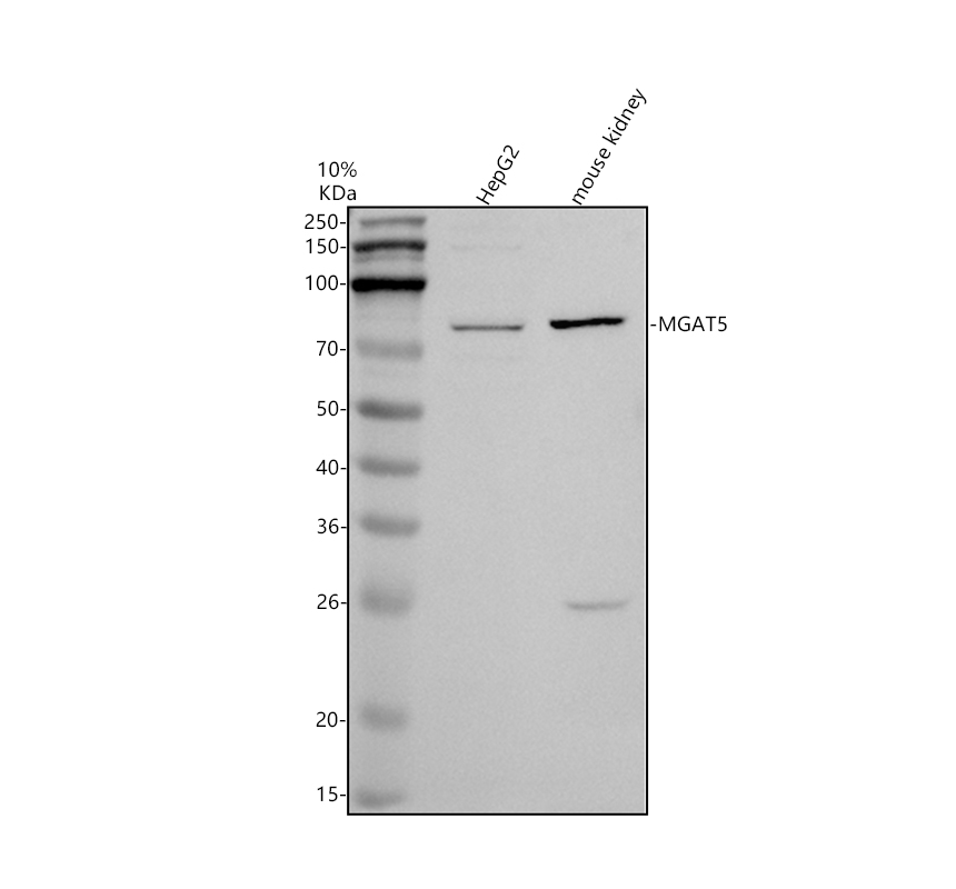 a08473 1 mgat5 primary antibodies wb testing 1