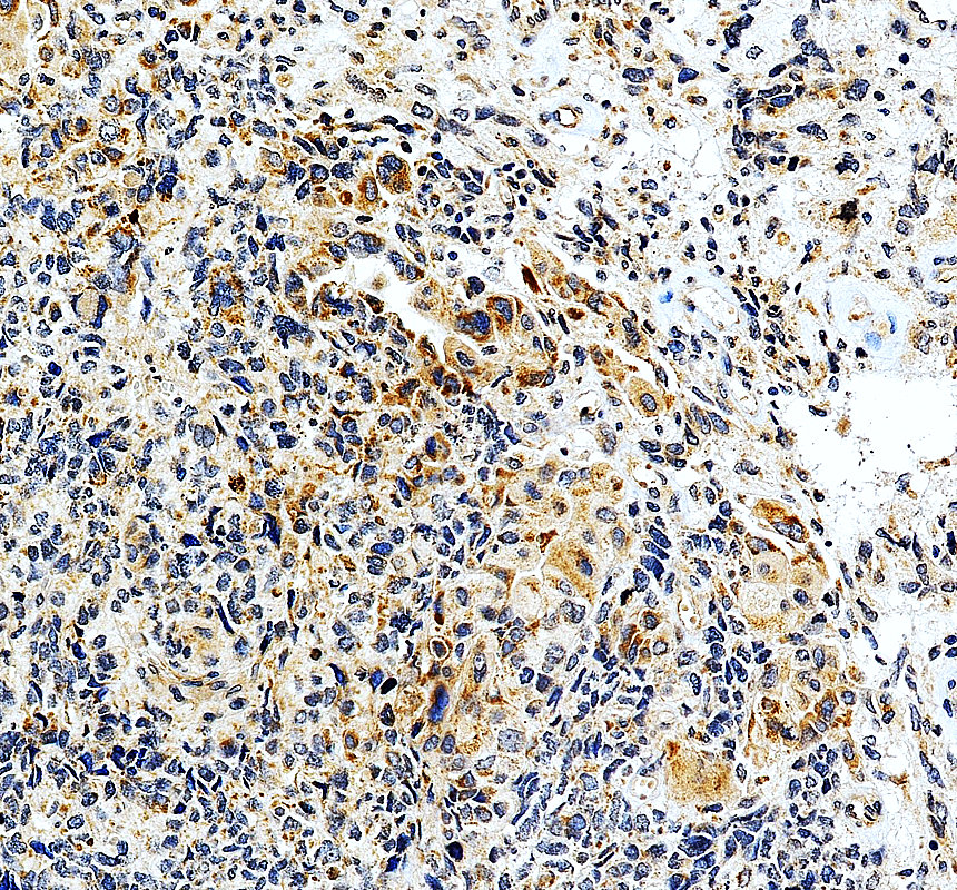 IHC analysis of MGAT4A using anti-MGAT4A antibody (A08474-1)