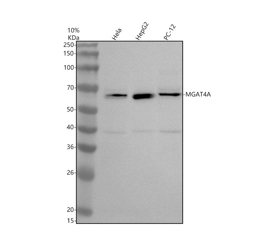 Western blot analysis of MGAT4A using anti-MGAT4A antibody (A08474-1)